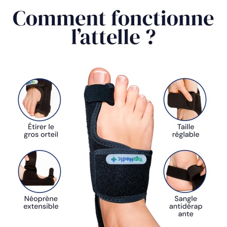 Varbaeraldajate komplekt – 2 varbaeraldajat ja 2 öist lahast | Mugav jalatoe lahendus päevaks ja ööks